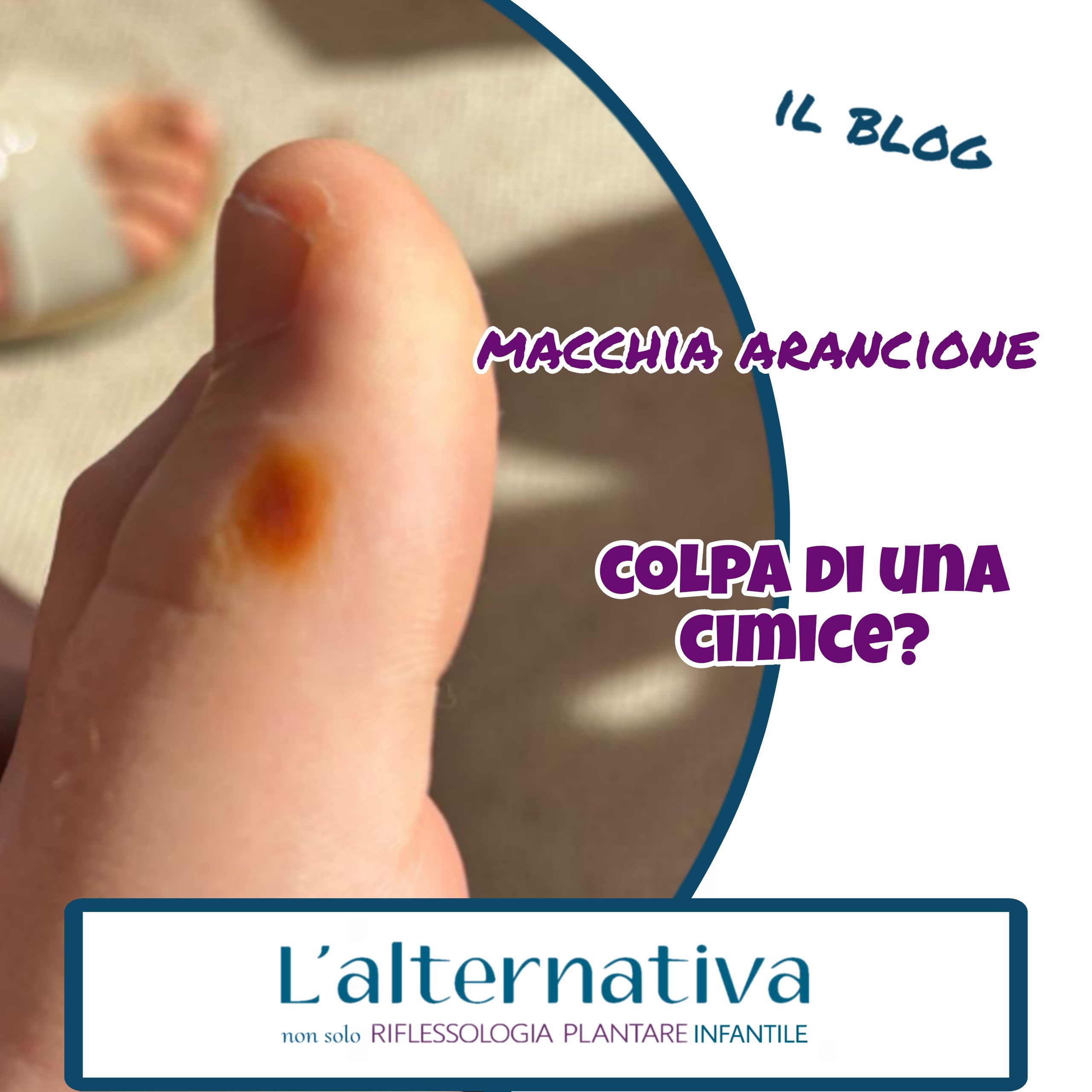 macchia arancione sul piede